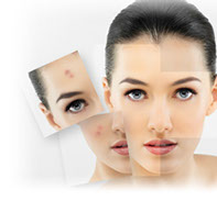 dark spot treatment