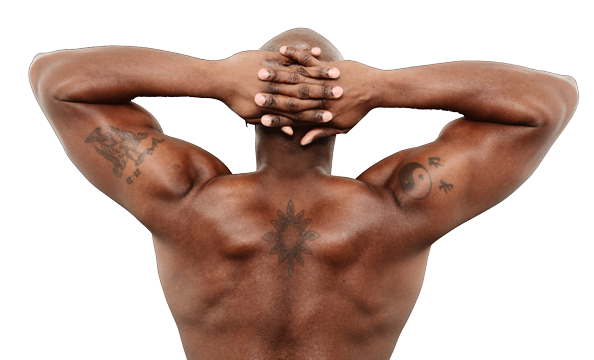 laser tattoo removal